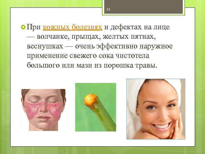 34 При кожных болезнях и дефектах на лице — волчанке, прыщах, желтых пятнах, веснушках