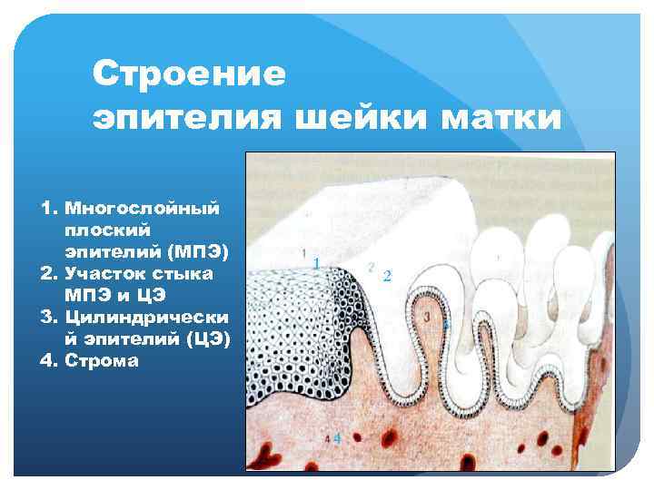 Строение эпителия шейки матки 1. Многослойный плоский эпителий (МПЭ) 2. Участок стыка МПЭ и