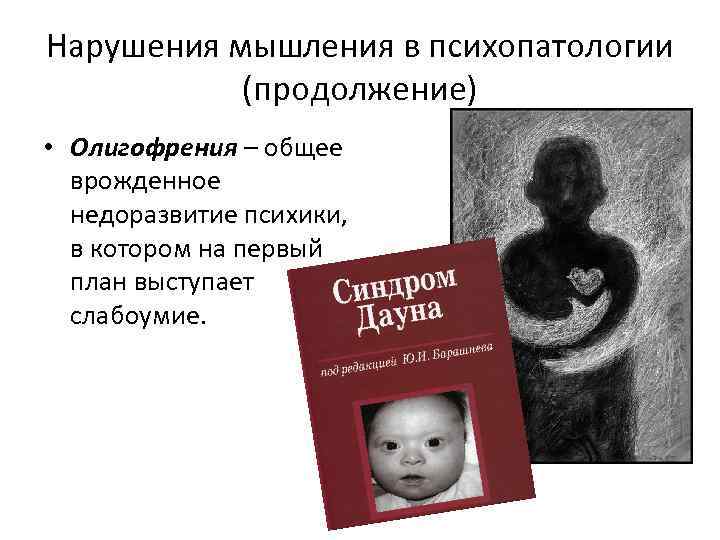 Нарушения мышления в психопатологии (продолжение) • Олигофрения – общее врожденное недоразвитие психики, в котором