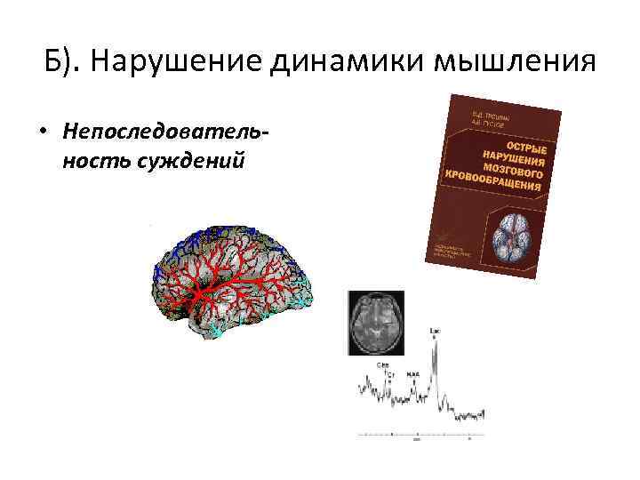 Б). Нарушение динамики мышления • Непоследовательность суждений 