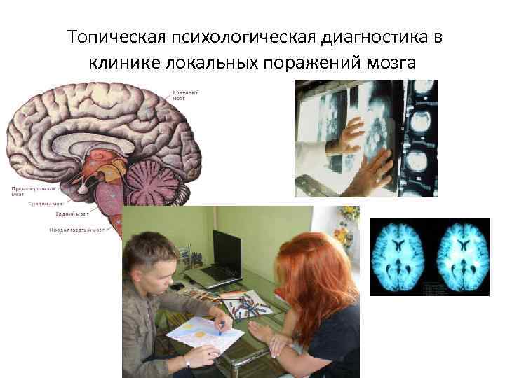 Локальные поражения мозга это. Локальные поражения мозга. Методы топической диагностики поражений мозга. Локальные поражения мозга картинка. Диагностика по рисунками людей с локальным поражением мозга.