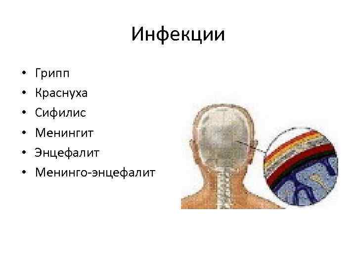 Инфекции • • • Грипп Краснуха Сифилис Менингит Энцефалит Менинго-энцефалит 