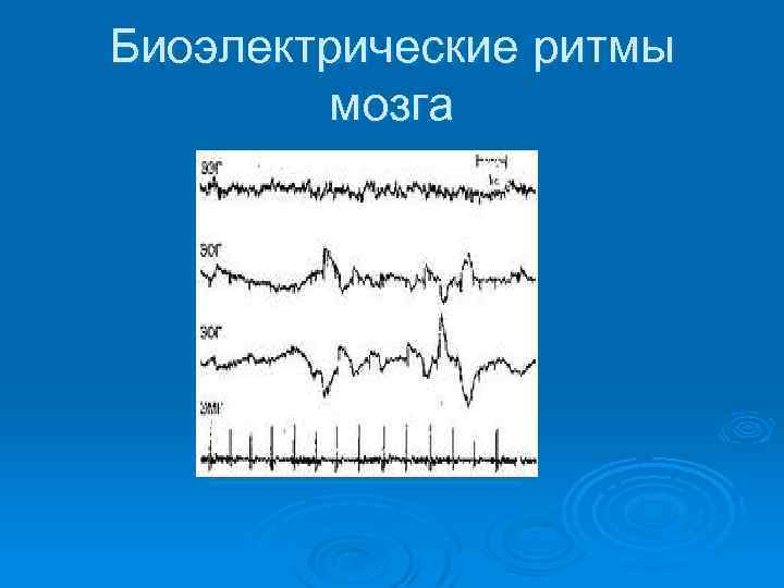 Биоэлектрические ритмы мозга 