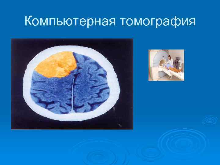 Компьютерная томография 