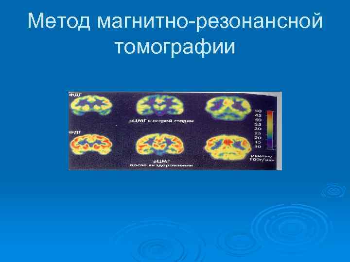 Метод магнитно-резонансной томографии 