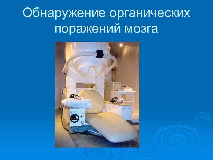 Обнаружение органических поражений мозга 
