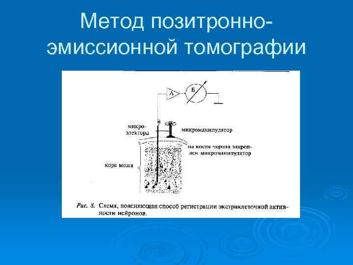 Метод позитронноэмиссионной томографии 