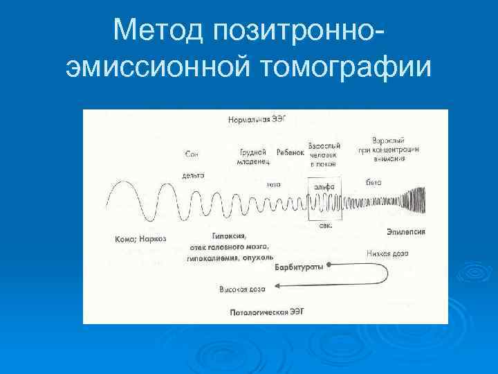 Метод позитронноэмиссионной томографии 