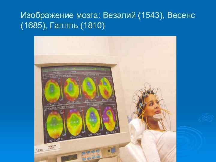 Изображение мозга: Везалий (1543), Весенс (1685), Галлль (1810) 