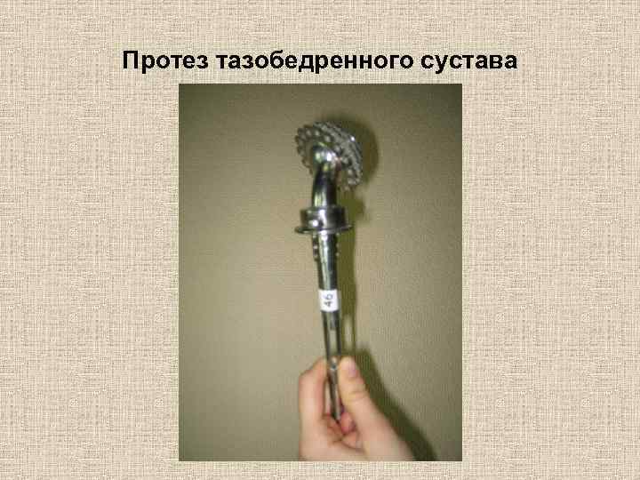 Протез тазобедренного сустава 