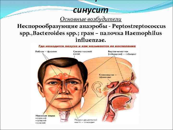 Частые синуситы