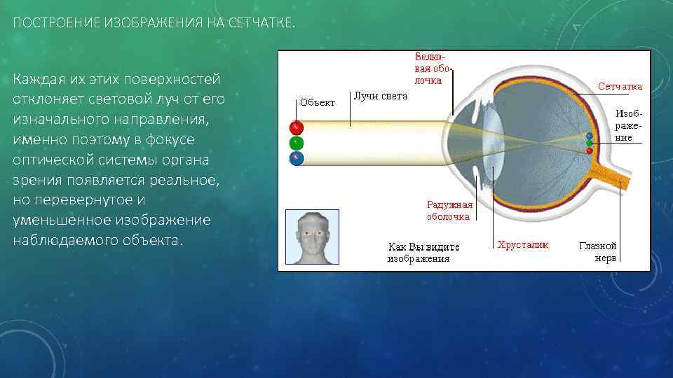 ПОСТРОЕНИЕ ИЗОБРАЖЕНИЯ НА СЕТЧАТКЕ. Каждая их этих поверхностей отклоняет световой луч от его изначального