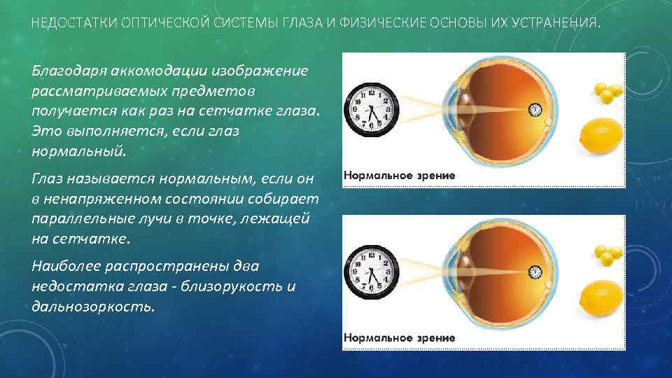 НЕДОСТАТКИ ОПТИЧЕСКОЙ СИСТЕМЫ ГЛАЗА И ФИЗИЧЕСКИЕ ОСНОВЫ ИХ УСТРАНЕНИЯ. Благодаря аккомодации изображение рассматриваемых предметов