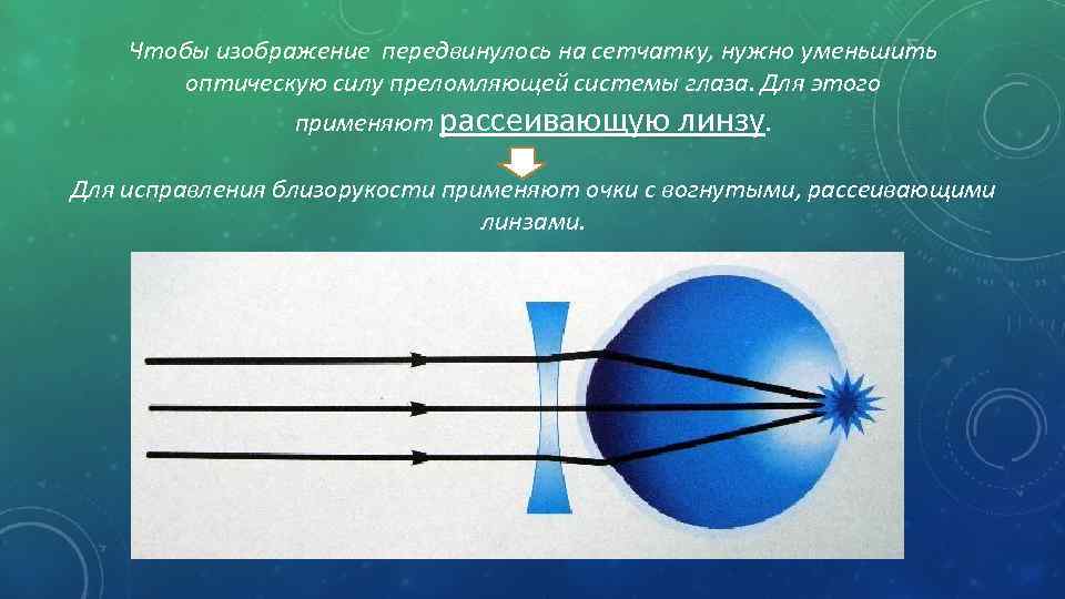 Чтобы изображение передвинулось на сетчатку, нужно уменьшить оптическую силу преломляющей системы глаза. Для этого