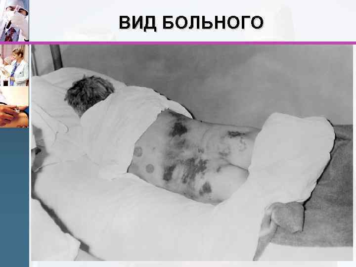 ВИД БОЛЬНОГО 