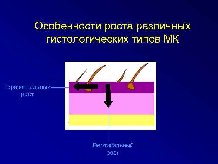 Особенности роста различных гистологических типов МК Горизонтальный рост Вертикальный рост 