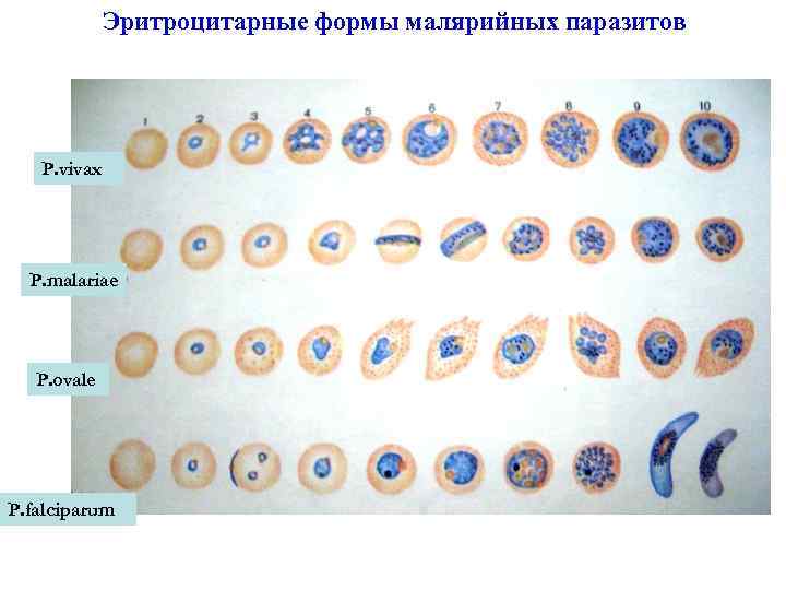 Эритроцитарные формы малярийных паразитов P. vivax P. malariae P. ovale P. falciparum 