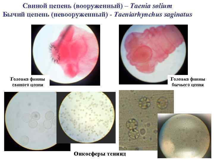 Свиной цепень (вооруженный) – Taenia solium Бычий цепень (невооруженный) - Taeniarhynchus saginatus Головка финны