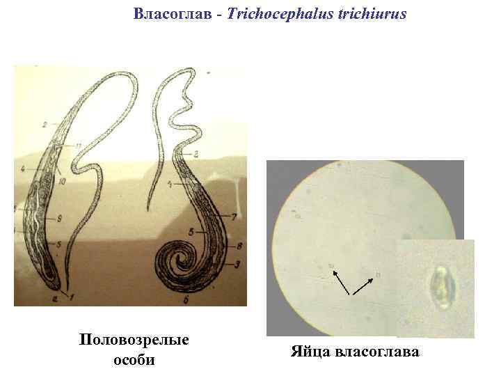 Власоглав - Trichocephalus trichiurus Половозрелые особи Яйца власоглава 