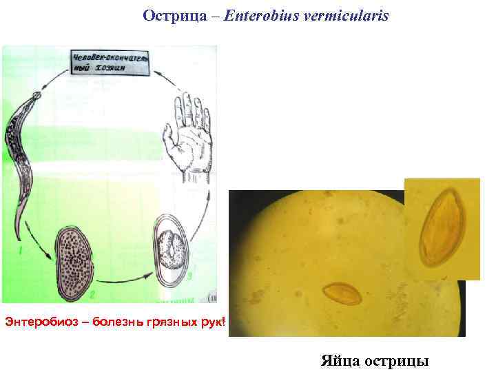 Острица – Enterobius vermicularis Энтеробиоз – болезнь грязных рук! Яйца острицы 