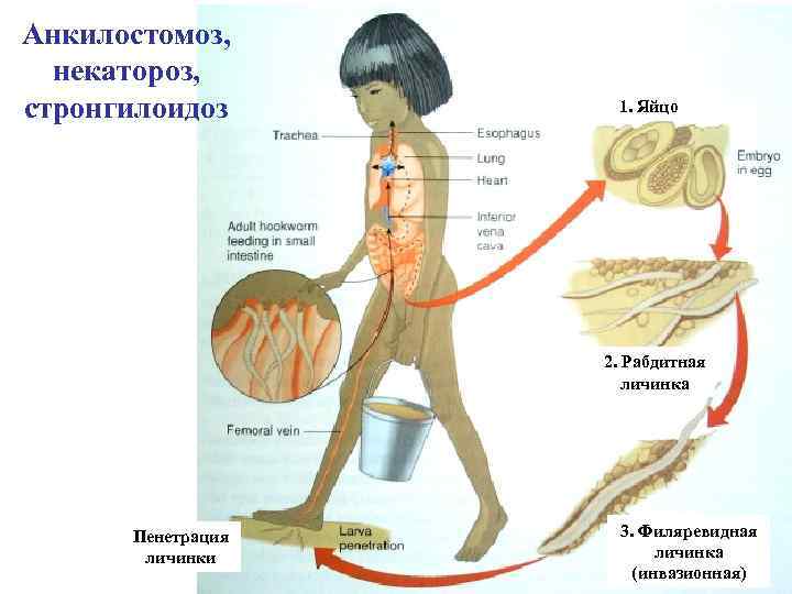 Анкилостомоз, некатороз, стронгилоидоз 1. Яйцо 2. Рабдитная личинка Пенетрация личинки 3. Филяревидная личинка (инвазионная)