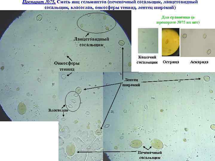Препарат № 75. Смесь яиц гельминтов (печеночный сосальщик, ланцетовидный сосальщик, власоглав, онкосферы тениид, лентец