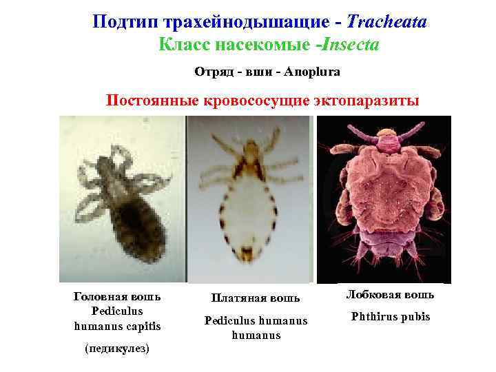 Подтип трахейнодышащие - Tracheata Класс насекомые -Insecta Отряд - вши - Anoplura Постоянные кровососущие