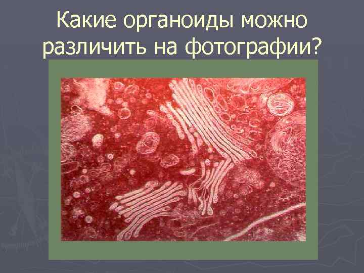 Какие органоиды можно различить на фотографии? 