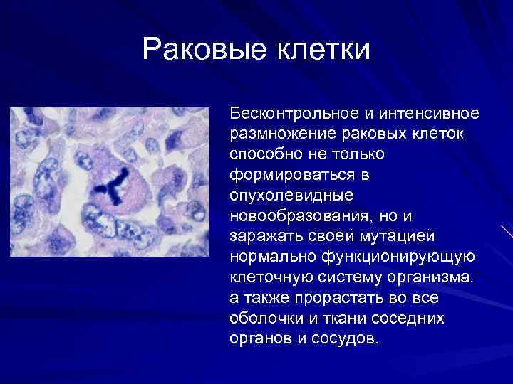Раковые клетки Бесконтрольное и интенсивное размножение раковых клеток способно не только формироваться в опухолевидные