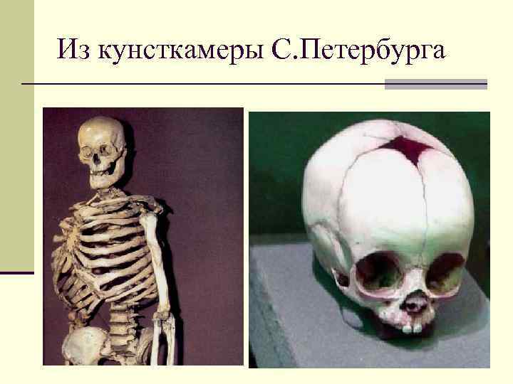 Из кунсткамеры С. Петербурга 