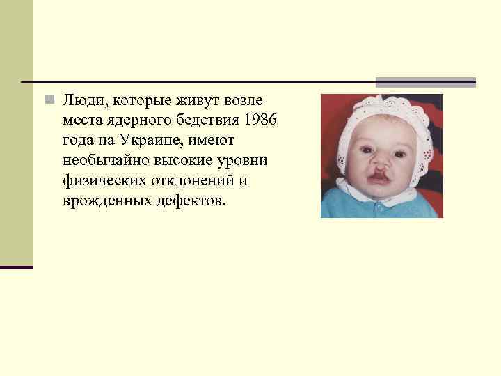 n Люди, которые живут возле места ядерного бедствия 1986 года на Украине, имеют необычайно