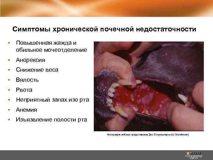 Симптомы хронической почечной недостаточности ▪ Повышенная жажда и обильное мочеотделение ▪ Анорексия ▪ Снижение