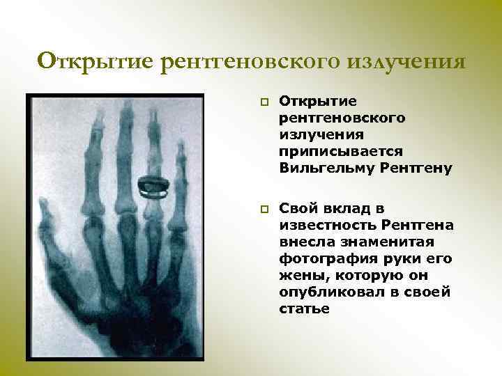 Открытие рентгеновского излучения p Открытие рентгеновского излучения приписывается Вильгельму Рентгену p Свой вклад в