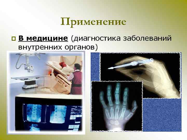 Применение p В медицине (диагностика заболеваний внутренних органов) 