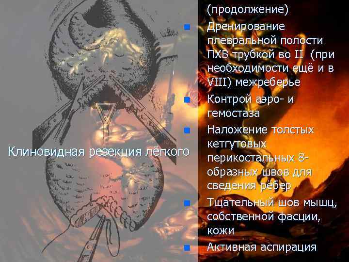  (продолжение) n Дренирование плевральной полости ПХВ трубкой во II (при необходимости ещё и