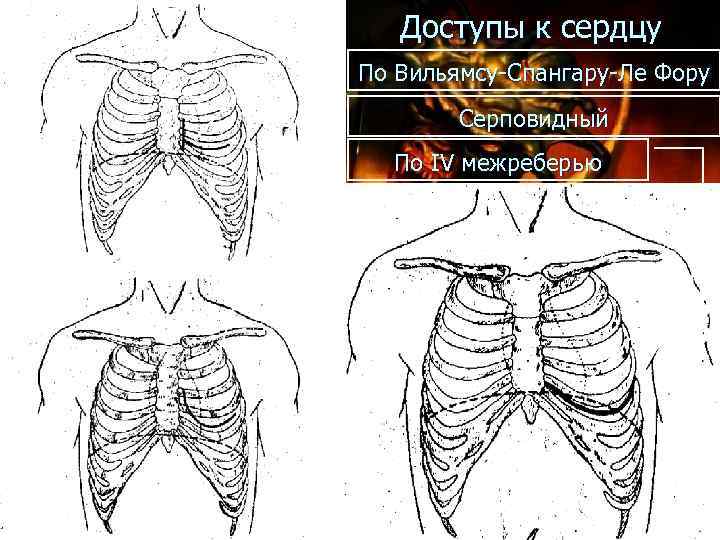 Межреберья схема у человека