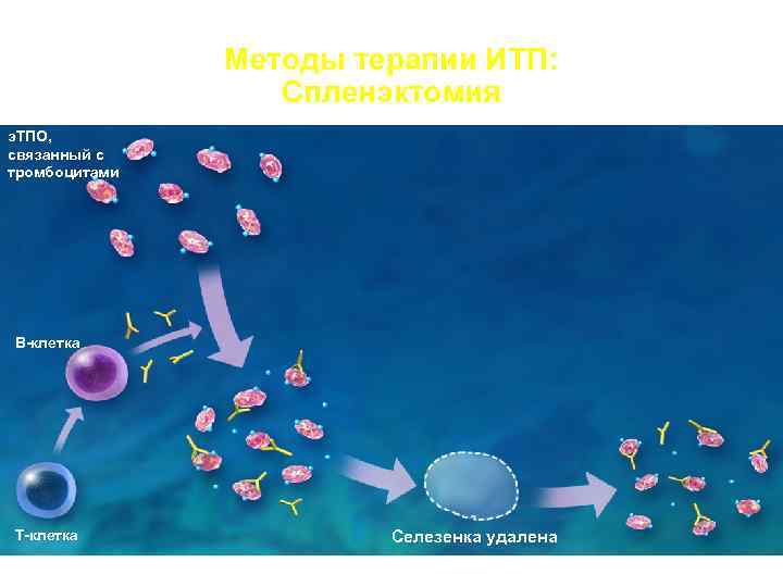  Методы терапии ИТП: Спленэктомия э. ТПО, связанный с тромбоцитами В-клетка Т-клетка Селезенка удалена