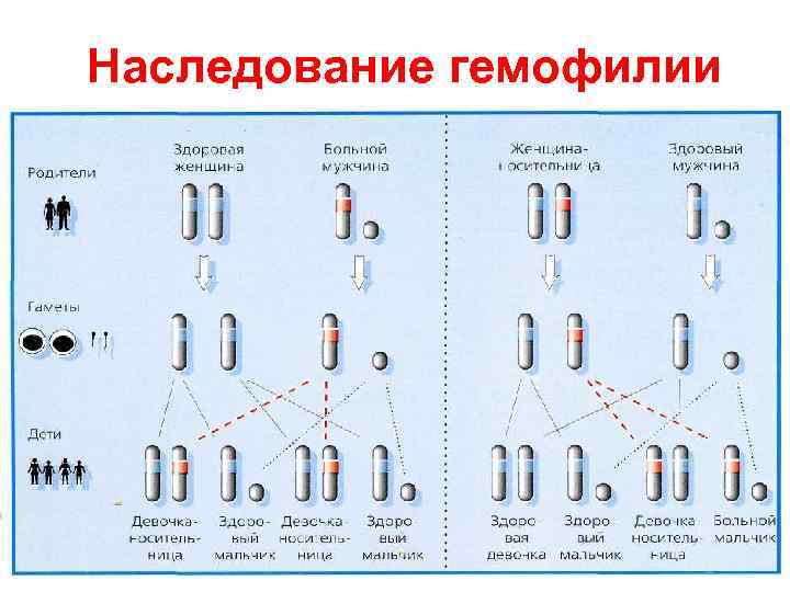 Наследование гемофилии 