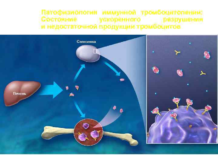  Патофизиология иммунной тромбоцитопении: Состояние ускоренного разрушения и недостаточной продукции тромбоцитов Селезенка Печень Синие