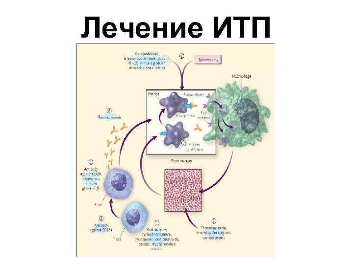 Лечение ИТП 