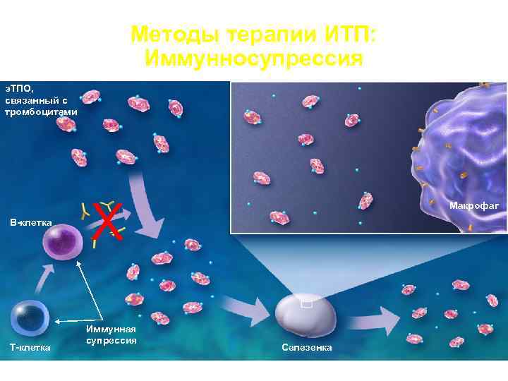  Методы терапии ИТП: Иммунносупрессия э. ТПО, связанный с тромбоцитами X Макрофаг В-клетка Иммунная