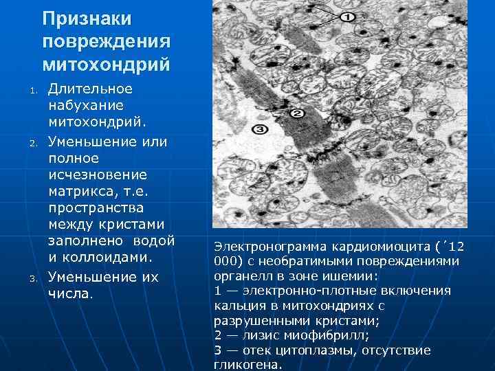 Признаки повреждения митохондрий 1. 2. 3. Длительное набухание митохондрий. Уменьшение или полное исчезновение матрикса,