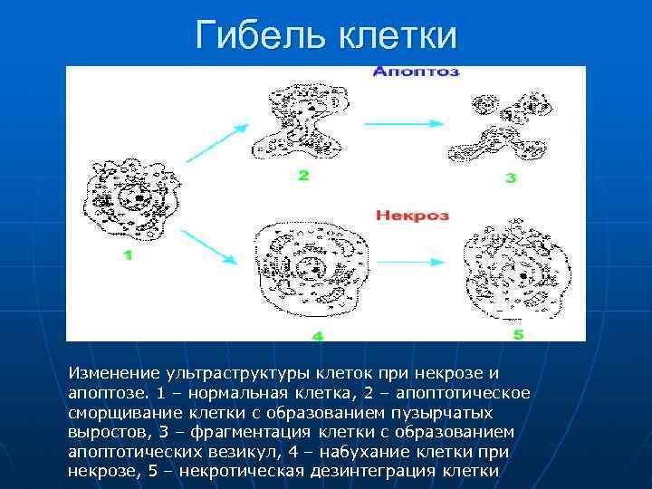 Гибель клетки Изменение ультраструктуры клеток при некрозе и апоптозе. 1 – нормальная клетка, 2