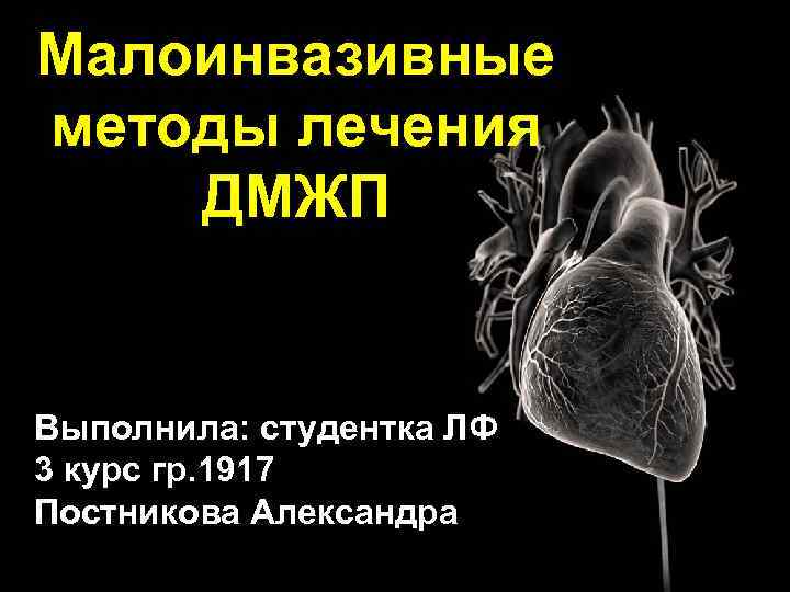 Малоинвазивные методы лечения ДМЖП Выполнила: студентка ЛФ 3 курс гр. 1917 Постникова Александра 