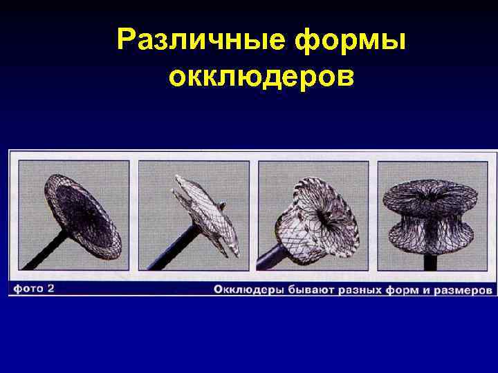 Различные формы окклюдеров 