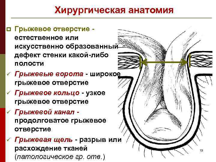 Хирургическая анатомия p ü ü Грыжевое отверстие естественное или искусственно образованный дефект стенки какой-либо