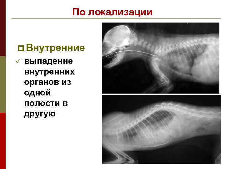 Выпадение внутренних геморроидальных узлов фото