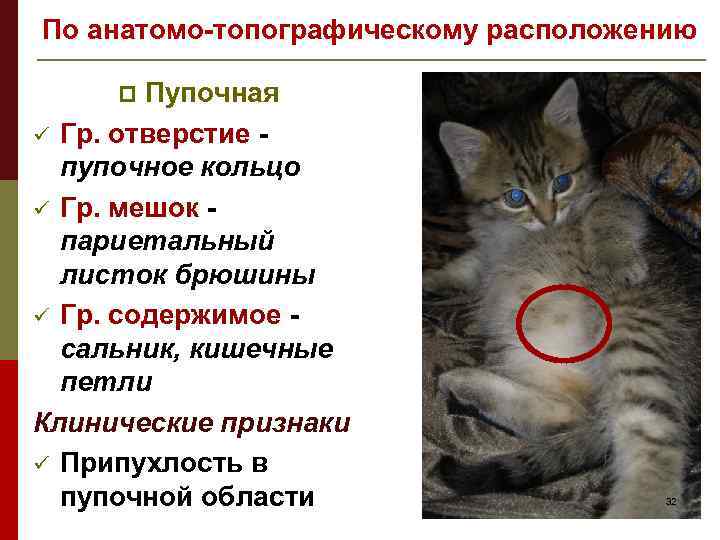 По анатомо-топографическому расположению Пупочная ü Гр. отверстие пупочное кольцо ü Гр. мешок париетальный листок
