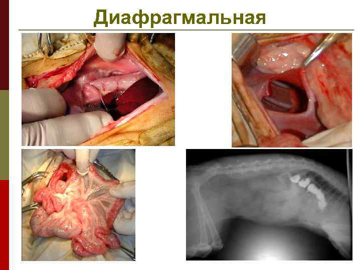 Диафрагмальная 34 
