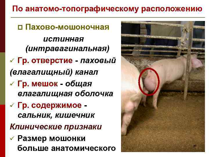 По анатомо-топографическому расположению Пахово-мошоночная истинная (интравагинальная) ü Гр. отверстие - паховый (влагалищный) канал ü